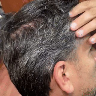 Recupera la vitalidad y el color natural de tu cabello sin usar tintes agresivos