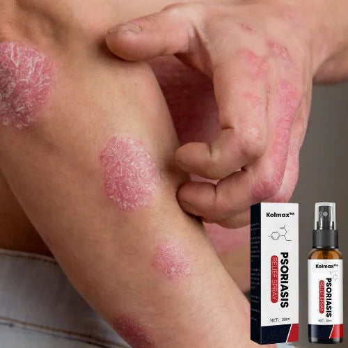 Spray Kolmax™ – Alivio rápido para piel irritada, seca o escamosa