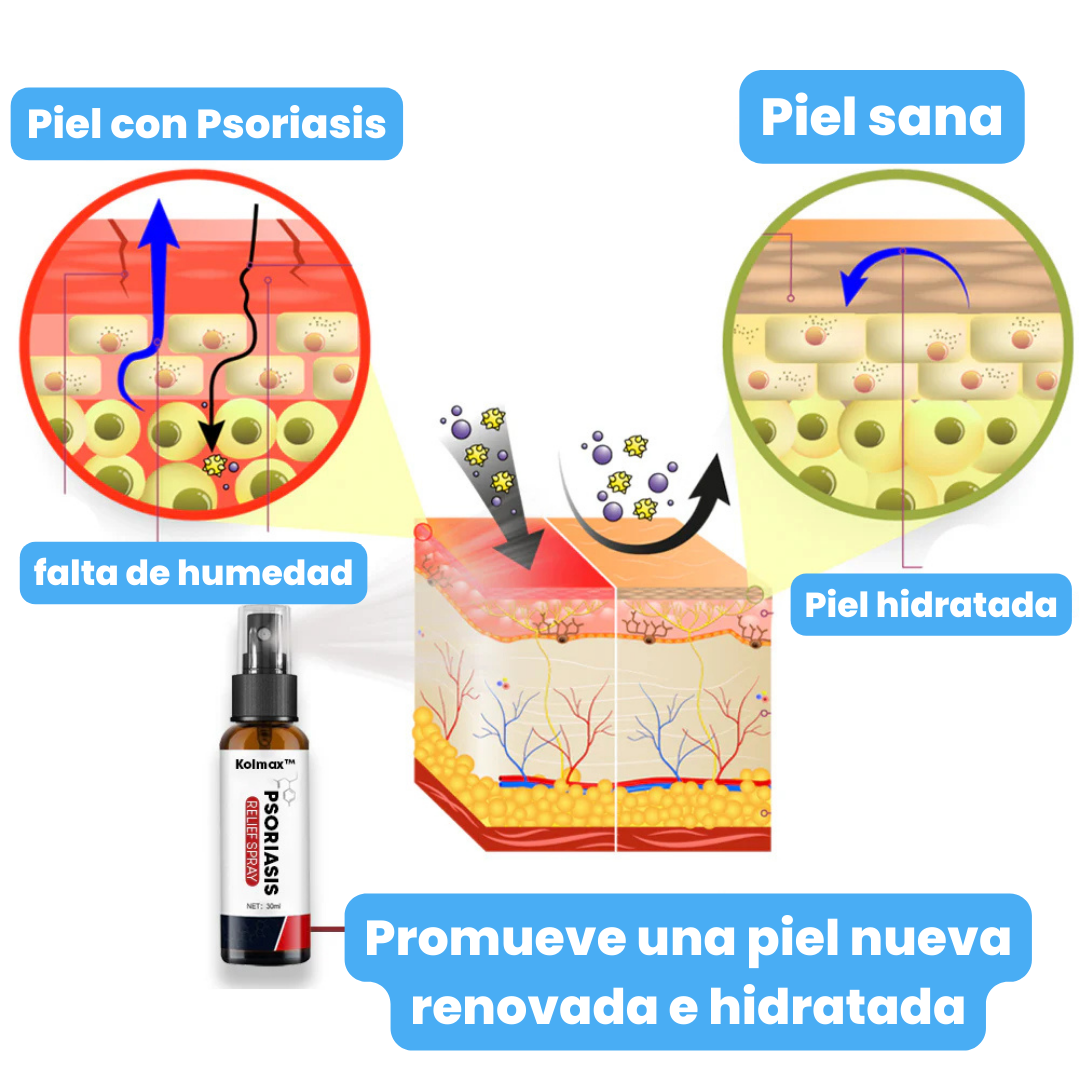 Spray Kolmax™ – Alivio rápido para piel irritada, seca o escamosa